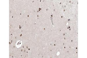 ABIN6266648 at 1/100 staining human brain tissue sections by IHC-P. (CDK7 Antikörper  (Internal Region))