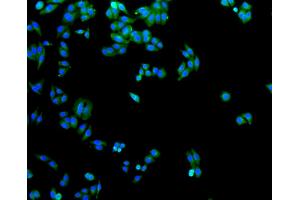 Immunofluorescence analysis of HepG2 cells using SLC2A1 antibody (ABIN5997113).