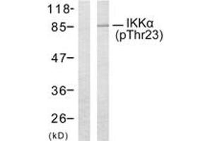 Western blot analysis of extracts from MDA-MB-435 cells treated with EGF, using IKK-alpha (Phospho-Thr23) Antibody. (IKK alpha Antikörper  (pThr23))