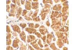 Immunohistochemical staining of human heart tissue using AP30264PU-N CX3CR1 antibody at 2 μg/ml. (CX3CR1 Antikörper  (N-Term))