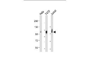 All lanes : Anti-LP2 Antibody at 1:2000-8000 dilution Lane 1: HeLat whole cell lysate Lane 2: T47D whole cell lysate Lane 3: Jurkat whole cell lysate Lysates/proteins at 20 μg per lane. (LAMP2 Antikörper)