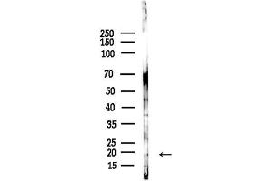 Western blot analysis of lysates from COLO205 cells(heat-shock,45 min treatment), using Phospho-Synuclein alpha (Ser129) Antibody at 1/1000 dilution.