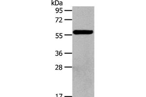 Western Blot analysis of Hela cell using HDAC7 Polyclonal Antibody at dilution of 1:100 (HDAC7 Antikörper)