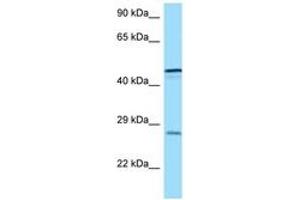 Image no. 1 for anti-Triggering Receptor Expressed On Myeloid Cells 1 (TREM1) (AA 162-211) antibody (ABIN6748121) (TREM1 Antikörper  (AA 162-211))
