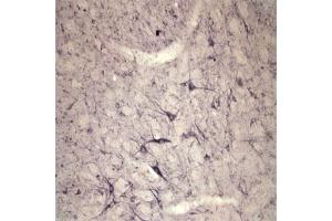 IHC on rat spinal cord using Rabbit antibody to extracellular, N-terminal part of Sortilin (Neurotensin receptor 3, NTR3, Sort1): IgG  at a concentration of 10 µg/ml. (Sortilin 1 Antikörper)