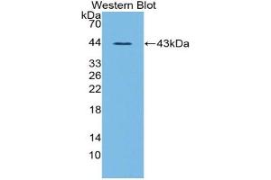 Western blot analysis of the recombinant protein. (Ghrelin Antikörper  (AA 28-117))