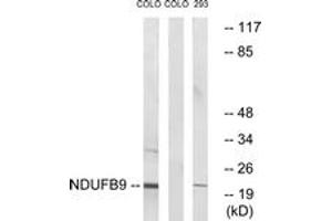 Western Blotting (WB) image for anti-NADH Dehydrogenase (Ubiquinone) 1 beta Subcomplex, 9, 22kDa (NDUFB9) (AA 102-151) antibody (ABIN2890437) (NDUFB9 Antikörper  (AA 102-151))