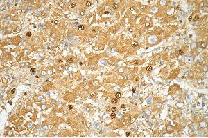 anti-Mannose Receptor (MR) antibody