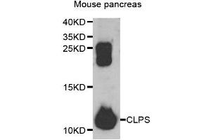 Western blot analysis of extracts of mouse pancreas, using CLPS antibody. (CLPS Antikörper)