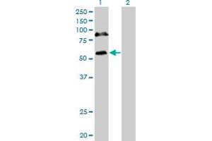 Western Blot analysis of RBM6 expression in transfected 293T cell line by RBM6 monoclonal antibody (M16), clone 4B3. (RBM6 Antikörper  (AA 1024-1123))