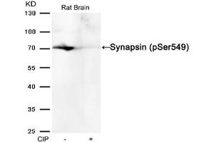Western blot analysis of extracts from Rat brain tissue or calf intestinal phosphatase (CIP), using Synapsin (phospho-Ser549) Antibody. (SYN1 Antikörper  (pSer549))