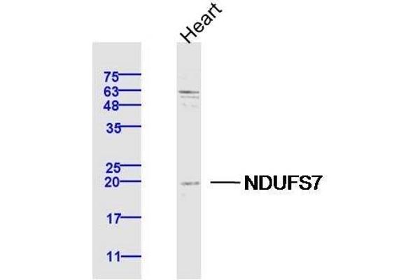 NDUFS7 Antikörper  (AA 101-160)