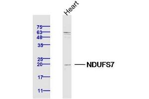 Lane 1: Mouse Heart lysates probed with NDUFS7 Polyclonal Antibody, Unconjugated  at 1:300 overnight at 4˚C.