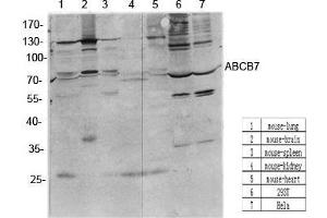 Western Blot (WB) analysis of specific cells using antibody diluted at 1:1000. (ABCB7 Antikörper  (C-Term))