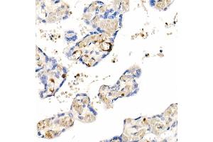 Immunohistochemistry of paraffin-embedded Human placenta using IGF1 antibody (ABIN1682184, ABIN3015345, ABIN3015346 and ABIN7101347) at dilution of 1:100 (40x lens). (IGF1 Antikörper)