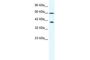 WB Suggested Anti-MCM7 Antibody Titration:  2. (MCM7 Antikörper  (N-Term))