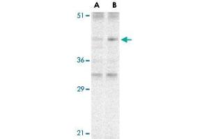 Western blot analysis of CARD8 expression in K-562 cell lysate with CARD8 polyclonal antibody  at (A) 2 and (B) 4 ug /mL .