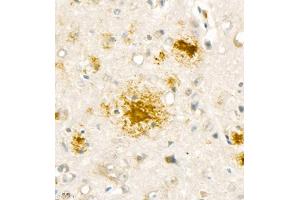 Immunohistochemistry analysis of paraffin embedded mouse Alzheimer',s brain using Aβ40 (ABIN7073042) at dilution of 1:1000 (Abeta 1-40 Antikörper)