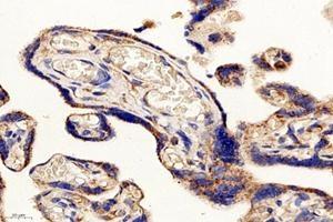 Immunohistochemistry (Paraffin-embedded Sections) (IHC (p)) image for anti-Proteasome (Prosome, Macropain) 26S Subunit, Non-ATPase, 8 (PSMD8) antibody (ABIN7075226)
