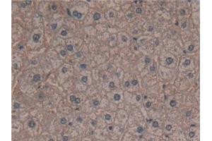 Immunohistochemistry (IHC) image for anti-Ribosomal Protein S6 Kinase, 90kDa, Polypeptide 1 (RPS6KA1) (AA 62-321) antibody (ABIN7441682)