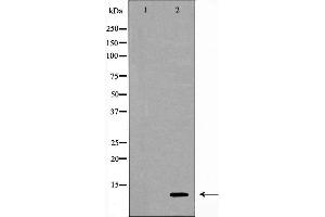 Western blot analysis of extracts of THP-1 , using CSTA antibody. (CSTA Antikörper  (C-Term))