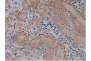 IHC-P analysis of Mouse Kidney Tissue, with DAB staining. (TCF20 Antikörper  (AA 1871-1965))