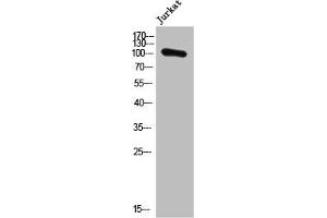 Western Blot analysis of Jurkat cells using PMS1 Polyclonal Antibody (PMS1 Antikörper  (Internal Region))