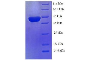 Protein expressed in E. (CA1 Protein (AA 2-261, full length) (His tag))