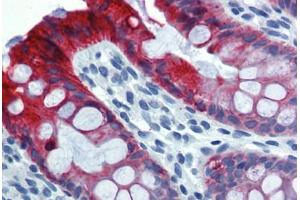 Colon, Human: Formalin-Fixed, Paraffin-Embedded (FFPE) (Cytokeratin 18 Antikörper)