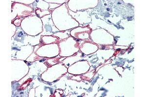 Anti-NFIC antibody IHC of normal human adrenal (adipocytes). (NFIC Antikörper  (AA 323-372))
