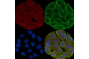 ABIN6259981 and ABIN6276533 staining Hela cells(30 min of UV treatment) by IF/ICC.
