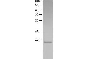 Western Blotting (WB) image for FK506 Binding Protein 1B, 12.6 KDa (FKBP1B) (AA 1-108) protein (His tag) (ABIN7122974)