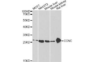 Western blot analysis of extracts of various cell lines, using CCNC antibody (ABIN2561645) at 1:1000 dilution. (Cyclin C Antikörper)