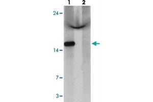 Western blot analysis of C1orf64 in HeLa cell lysate with C1orf64 polyclonal antibody  at 1 ug/mL in (lane 1) the absence and (lane 2) the presence of blocking peptide. (C1orf64 Antikörper  (C-Term))
