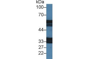 Western Blot; Sample: Mouse Stomach lysate; Primary Ab: 2µg/ml Rabbit Anti-Mouse IL18R1 Antibody Second Ab: 0. (IL18R1 Antikörper  (AA 391-518))