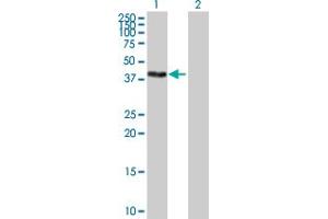Western Blot analysis of ZSCAN16 expression in transfected 293T cell line by ZSCAN16 MaxPab polyclonal antibody. (ZSCAN16 Antikörper  (AA 1-348))