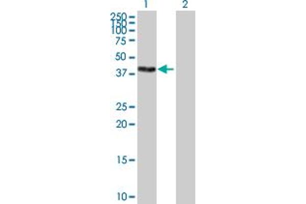 ZSCAN16 Antikörper  (AA 1-348)