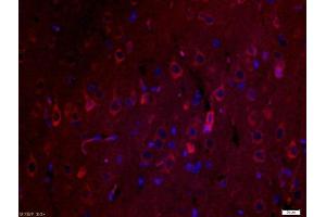 Immunofluorescence (Paraffin-embedded Sections) (IF (p)) image for anti-Secreted Protein, Acidic, Cysteine-Rich (Osteonectin) (SPARC) (AA 101-200) antibody (ABIN738141)