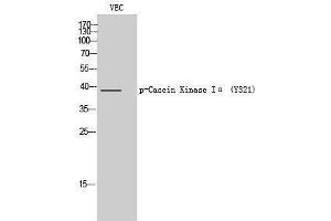 Western Blotting (WB) image for anti-Casein Kinase 1, alpha 1 (CSNK1A1) (pTyr321) antibody (ABIN3182288) (CSNK1A1 Antikörper  (pTyr321))