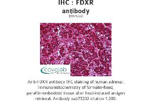 Image no. 2 for anti-Ferredoxin Reductase (FDXR) antibody (ABIN1734312) (Ferredoxin Reductase Antikörper)
