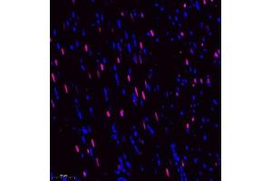 Immunofluorescence of paraffin embedded rat heart using DEPDC1 (ABIN7073717) at dilution of 1:500 (250x lens) (DEPDC1 Antikörper)