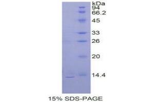 SDS-PAGE (SDS) image for Prokineticin 2 (PROK2) (AA 29-107) protein (His tag) (ABIN1080565) (PROK2 Protein (AA 29-107) (His tag))