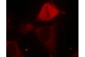 Immunofluorescence staining of methanol-fixed Hela cells using MKK3(Phospho-Ser189) Antibody. (MAP2K3 Antikörper  (pSer189))