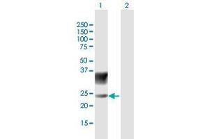 Western Blot analysis of SCN3B expression in transfected 293T cell line by SCN3B MaxPab polyclonal antibody. (SCN3B Antikörper  (AA 1-215))