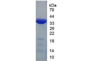 Image no. 1 for Interleukin 23, alpha subunit p19 (IL23A) (AA 20-189) protein (His tag) (ABIN1878770) (IL23A Protein (AA 20-189) (His tag))