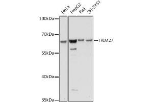 Western blot analysis of extracts of various cell lines, using TRIM27 antibody (ABIN7269922) at 1:1000 dilution. (TRIM27 Antikörper  (AA 1-200))