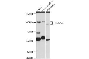 Western blot analysis of extracts of various cell lines, using HMGCR antibody (ABIN6132111, ABIN6141869, ABIN6141870 and ABIN6217262) at 1:1000 dilution. (HMGCR Antikörper  (AA 629-888))