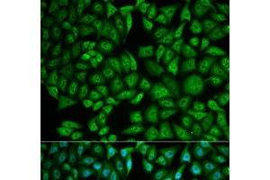 Immunofluorescence analysis of MCF-7 cells using CTSA Polyclonal Antibody (CTSA Antikörper)