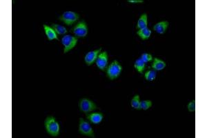 Immunofluorescence staining of Hela cells with ABIN7171862 at 1:100, counter-stained with DAPI. (Tetraspanin 18 Antikörper  (AA 151-223))