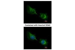 ICC/IF Image Immunofluorescence analysis of methanol-fixed HeLa, using Deltex1, antibody at 1:200 dilution. (Deltex Homolog 1 Antikörper  (Center))